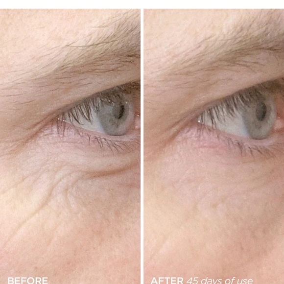 BeautyBio R45 The Reversal Retinol Boost Set - Picture 4 of 7